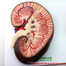 Verkaufen 12435 Medical Science Modell Nierenschnitt, Nephron und Glomerulus, Anatomie Modelle&gt; Urinal Models